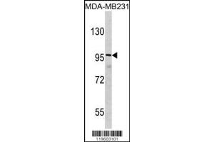 Western Blotting (WB) image for anti-Discs, Large (Drosophila) Homolog-Associated Protein 1 (DLGAP1) antibody (ABIN2158561)