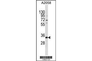 Image no. 1 for anti-TGFB-Induced Factor Homeobox 2-Like, X-Linked (TGIF2LX) (AA 149-175) antibody (ABIN1537878)
