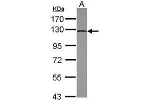 Image no. 2 for anti-Fibroblast Growth Factor Receptor 1 (FGFR1) (C-Term) antibody (ABIN2854680)