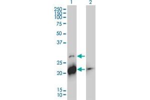 Image no. 1 for anti-BH3 Interacting Domain Death Agonist (BID) (AA 1-195) antibody (ABIN560060)