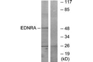 Image no. 1 for anti-Endothelin Receptor Type A (EDNRA) (AA 378-427) antibody (ABIN1535599)