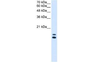 Image no. 1 for anti-Ubiquitously-Expressed, Prefoldin-Like Chaperone (UXT) (N-Term) antibody (ABIN2784464)