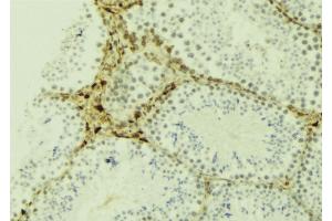 Image no. 2 for anti-Janus Kinase and Microtubule Interacting Protein 2 (JAKMIP2) antibody (ABIN6258675)
