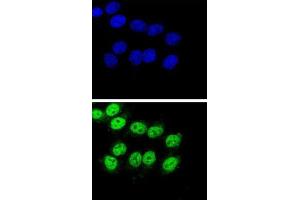 Image no. 3 for anti-BCL2-Associated Athanogene (BAG1) antibody (ABIN3001708)