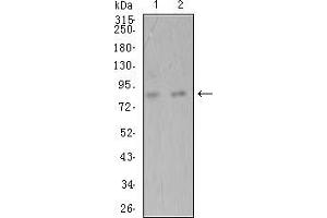 Image no. 4 for anti-ADAM Metallopeptidase with Thrombospondin Type 1 Motif, 1 (ADAMTS1) (AA 858-960) antibody (ABIN5542558)