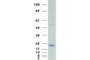 Image no. 1 for Dual Specificity Phosphatase 3 (DUSP3) protein (Myc-DYKDDDDK Tag) (ABIN2719836)
