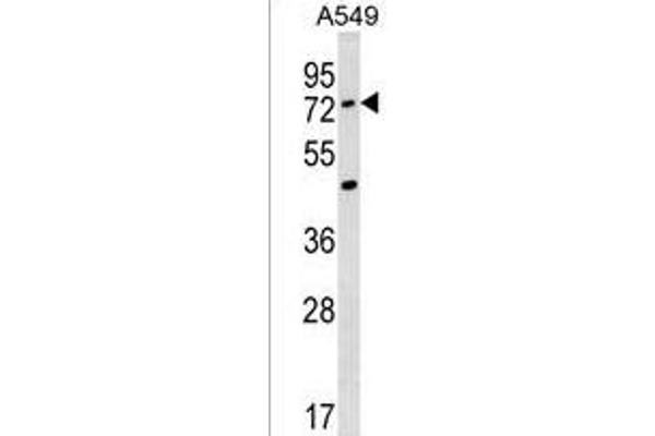 ACSM2A 抗体  (N-Term)