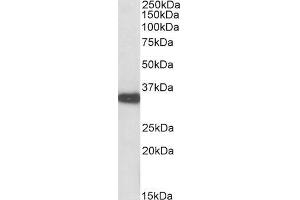 Image no. 1 for anti-Aspartoacylase (ASPA) (C-Term) antibody (ABIN5539471)