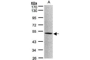 Image no. 3 for anti-MOK Protein Kinase (MOK) (Center) antibody (ABIN2856003)
