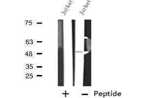 Image no. 2 for anti-Transmembrane Protein 237 (TMEM237) antibody (ABIN6258685)