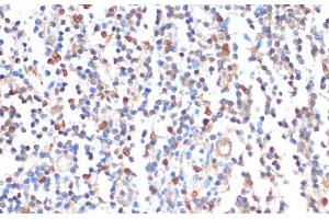 Immunohistochemistry of paraffin-embedded Human tonsil using ZMYM3 Polyclonal Antibody at dilution of 1:100 (40x lens).