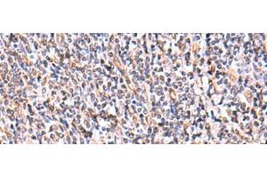 Immunohistochemistry of paraffin-embedded Human tonsil tissue using UXS1 Polyclonal Antibody at dilution of 1:60(x200)