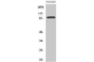 Image no. 1 for anti-Ewing Sarcoma Breakpoint Region 1 (EWSR1) (Internal Region) antibody (ABIN3184565)