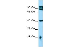 Image no. 1 for anti-MTERF Domain Containing 3 (MTERFD3) (N-Term) antibody (ABIN2790656)