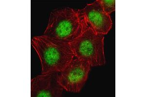 Image no. 1 for anti-cAMP Responsive Element Binding Protein 1 (CREB1) (AA 105-132) antibody (ABIN655653)