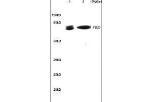 Image no. 3 for anti-B-Cell CLL/lymphoma 6 (BCL6) (AA 501-600) antibody (ABIN749843)