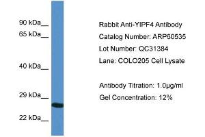 Image no. 1 for anti-Yip1 Domain Family, Member 4 (YIPF4) (N-Term) antibody (ABIN2788486)