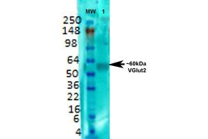 Image no. 1 for anti-Solute Carrier Family 17 (Vesicular Glutamate Transporter), Member 6 (SLC17A6) (AA 501-582) antibody (FITC) (ABIN2483744)