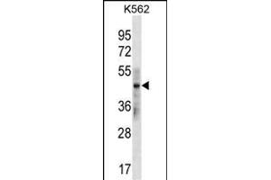 Keratin 33B anticorps  (N-Term)