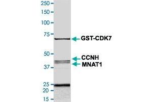 Image no. 1 for Cyclin-Dependent Kinase 7 (CDK7) (AA 1-346) protein (His-GST) (ABIN5569618)
