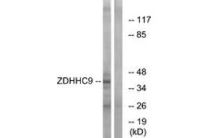 Image no. 1 for anti-Zinc Finger, DHHC-Type Containing 9 (ZDHHC9) (AA 315-364) antibody (ABIN1535143)