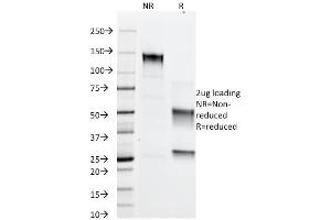 Image no. 1 for anti-Perilipin 2 (PLIN2) (AA 249-376) antibody (ABIN6939156)