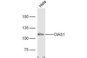 Image no. 7 for anti-NLR Family, Pyrin Domain Containing 3 (NLRP3) (AA 15-120) antibody (ABIN1386361)