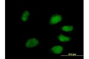 Image no. 1 for anti-Peptidylprolyl Isomerase (Cyclophilin)-Like 4 (PPIL4) (AA 1-492) antibody (ABIN529872)