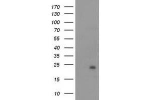 Image no. 1 for anti-NADH Dehydrogenase (Ubiquinone) 1 beta Subcomplex, 9, 22kDa (NDUFB9) (AA 3-179) antibody (ABIN2727035)