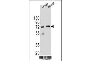 Image no. 1 for anti-Potassium Channel Tetramerisation Domain Containing 8 (KCTD8) (AA 434-462), (C-Term) antibody (ABIN655546)