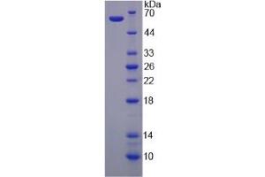 Image no. 1 for Voltage-Dependent Anion Channel 1 (VDAC1) (AA 2-283) protein (His tag,GST tag) (ABIN6237518)