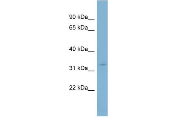 anti-Solute Carrier Family 25 (Carnitine/acylcarnitine Translocase), Member 20 (SLC25A20) (Middle Region) antibody