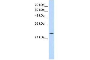 Image no. 2 for anti-Slow Skeletal Troponin I (TNNI1) antibody (ABIN632174)