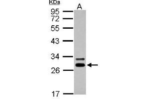 Image no. 1 for anti-Deoxycytidine Kinase (DCK) (Center) antibody (ABIN2856517)