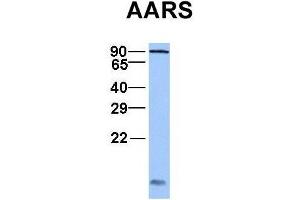 Image no. 3 for anti-Alanyl tRNA Synthetase (AARS) (C-Term) antibody (ABIN2778778)