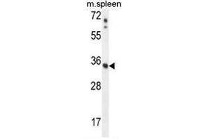 Image no. 2 for anti-Ankyrin Repeat and SOCS Box Containing 17 (ASB17) (AA 184-214), (C-Term) antibody (ABIN950528)