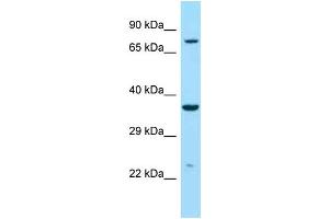 Image no. 1 for anti-Iduronidase, alpha-L- (IDUA) (C-Term) antibody (ABIN2789573)