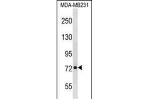 RMI1 Antibody (N-term) (ABIN1538950 and ABIN2848549) western blot analysis in MDA-M cell line lysates (35 μg/lane).