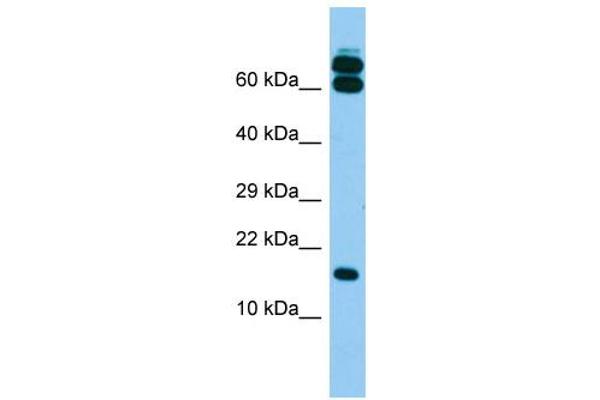 anti-B9 Protein Domain 2 (B9D2) (N-Term) antibody