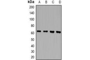 Image no. 2 for anti-TXK tyrosine Kinase (TXK) antibody (ABIN3222974)