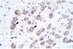 Immunohistochemical staining (Formalin-fixed paraffin-embedded sections) of human brain with LARP1 polyclonal antibody .