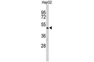 Image no. 3 for anti-CASP8 and FADD-Like Apoptosis Regulator (CFLAR) (AA 152-182), (Middle Region) antibody (ABIN951489)