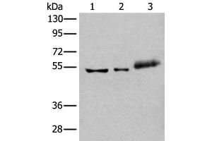 Western blot analysis of Hela cell Mouse kidney tissue and Human colorectal cancer tissue lysates using YY2 Polyclonal Antibody at dilution of 1:800