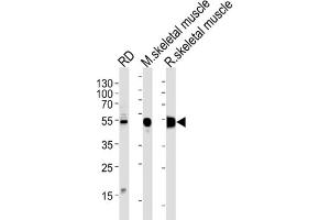 Image no. 1 for anti-Enolase 3 (Beta, Muscle) (ENO3) antibody (ABIN3001691)