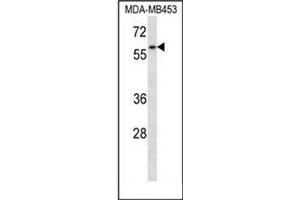 Image no. 2 for anti-Fanconi Anemia Complementation Group G (FANCG) (AA 539-568), (C-Term) antibody (ABIN955605)