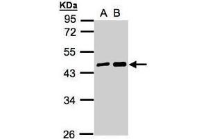 Image no. 1 for anti-Melanoma Antigen Family A, 11 (MAGEA11) (N-Term) antibody (ABIN2856757)