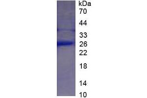 Image no. 3 for C-Reactive Protein (CRP) ELISA Kit (ABIN6574220)