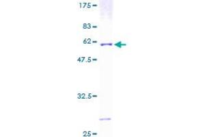 Image no. 1 for ATPase, H+ Transporting, Lysosomal 31kDa, V1 Subunit E1 (ATP6V1E1) (AA 1-226) protein (GST tag) (ABIN1346132)