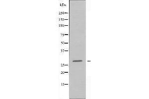 Image no. 2 for anti-Breast Cancer Metastasis Suppressor 1 (BRMS1) (N-Term) antibody (ABIN6256973)