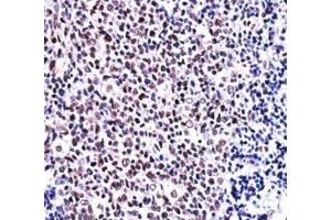 NFATC1 antibody immunohistochemistry analysis in formalin fixed and paraffin embedded human tonsil tissue.